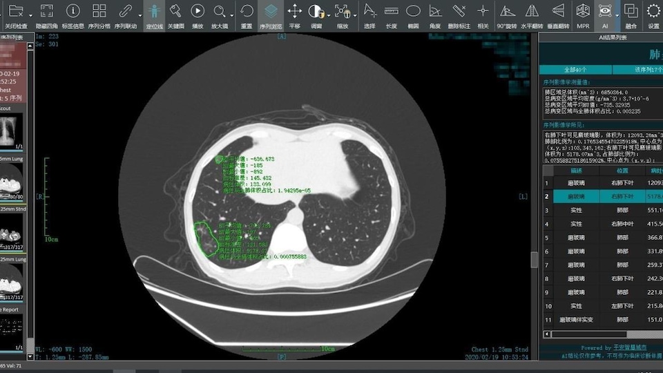 Capture d'écran d'un logiciel chinois de détection d'infections.