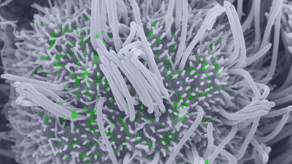 Image par microscopie électronique à balayage d'une cellule ciliée infectée par le SARS-CoV-2.