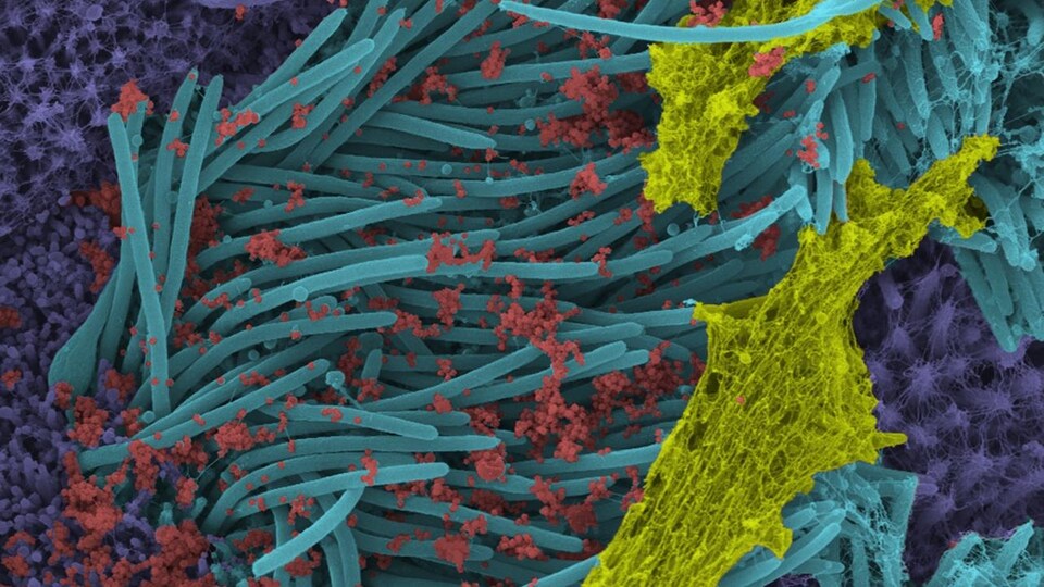 Cette image montre les virions (rouge) du SRAS-CoV-2 produits par l'épithélium des voies respiratoires humaines.