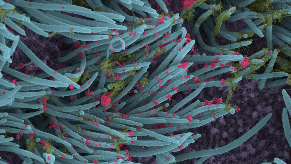 Image en microscopie électronique à balayage montrant des virions.
