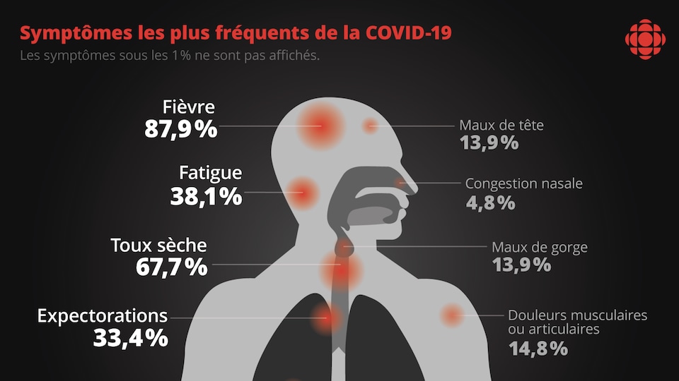 COVID19 Expliquée Par Un Microbiologiste