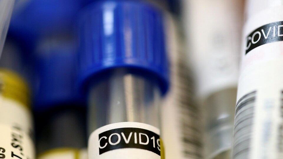 Un tube à essai avec un bouchon bleu et une étiquette sur laquelle on peut lire « COVID-19 ».