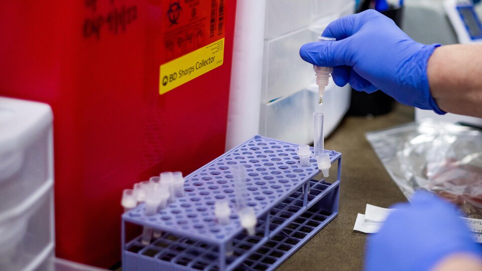 Dans un laboratoire médical, une main gantée dépose une petite goutte de liquide dans un tube posé sur un plateau.