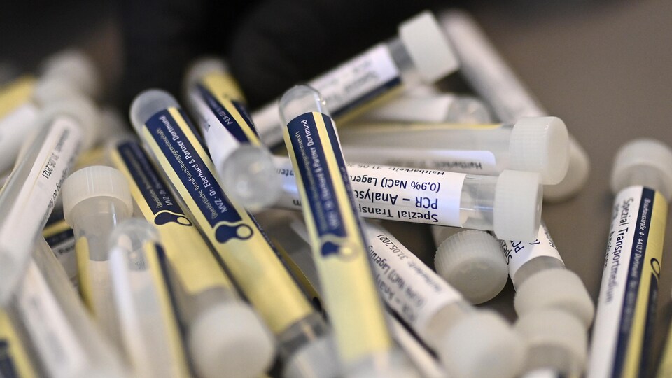 Des échantillons de tests de dépistage dans un centre médical.