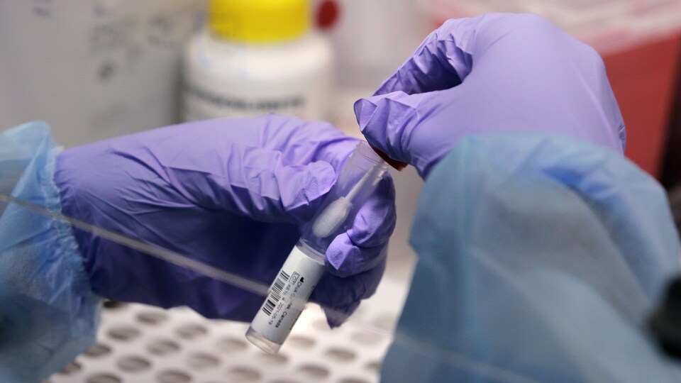 Des mains recouvertes de gants médicaux manipulent un tube et un écouvillon.