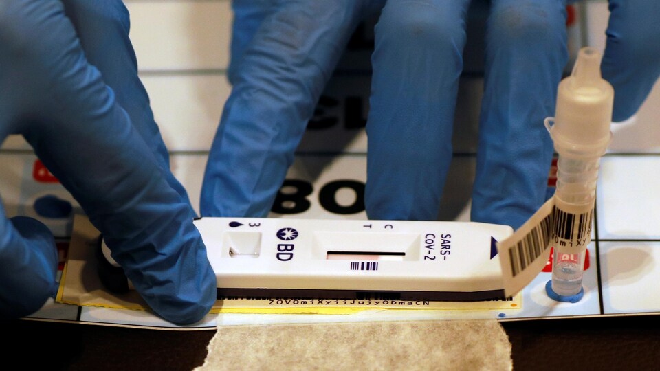 Un test de dépistage posé sur une table avec le résultat inscrit dessus.