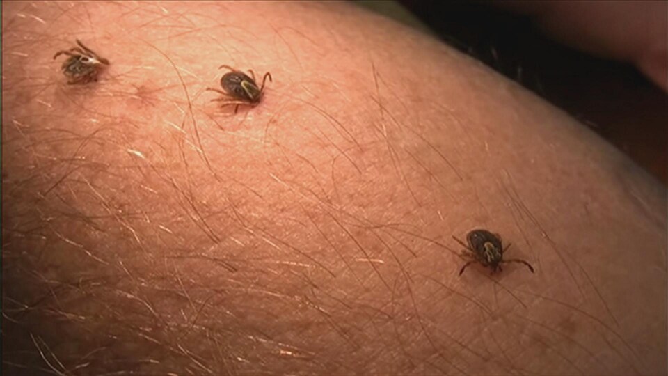 Une morsure de tique peut transmettre la maladie de Lyme