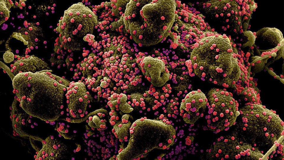 Une photo, prise au microscope électronique à balayage, de cellules infectées par le coronavirus qui cause la COVID-19.