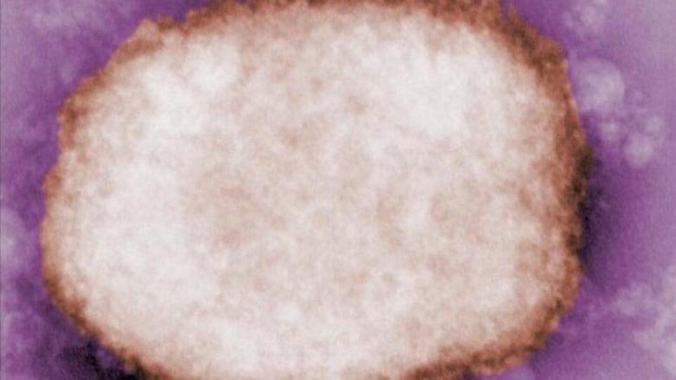 Une micrographie électronique à coloration négative montre une particule du virus de la variole simienne.