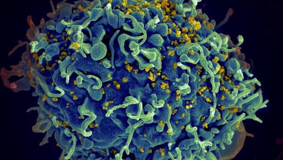 Le virus de l'immunodéficience humaine.