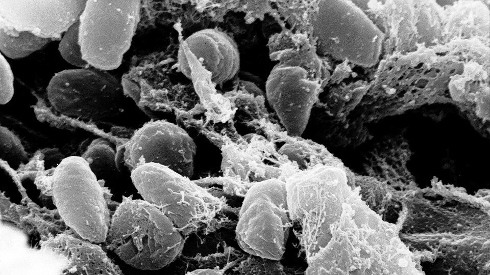 Photo représentant le bacille de la peste, Yersinia pestis.
