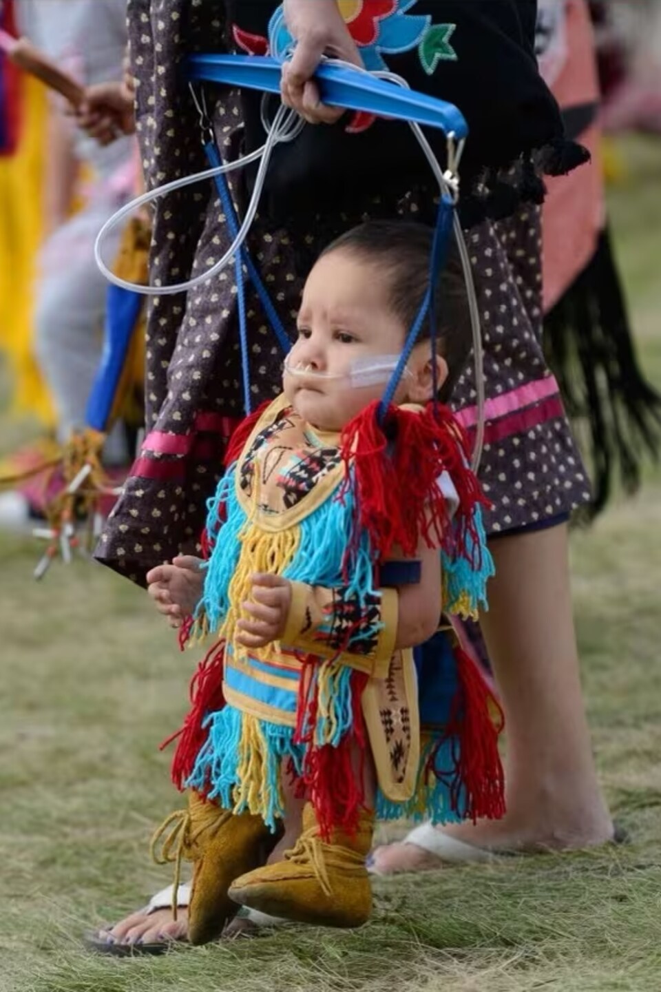 Un enfant en habit traditionnel autochtone est soutenu par une attelle.