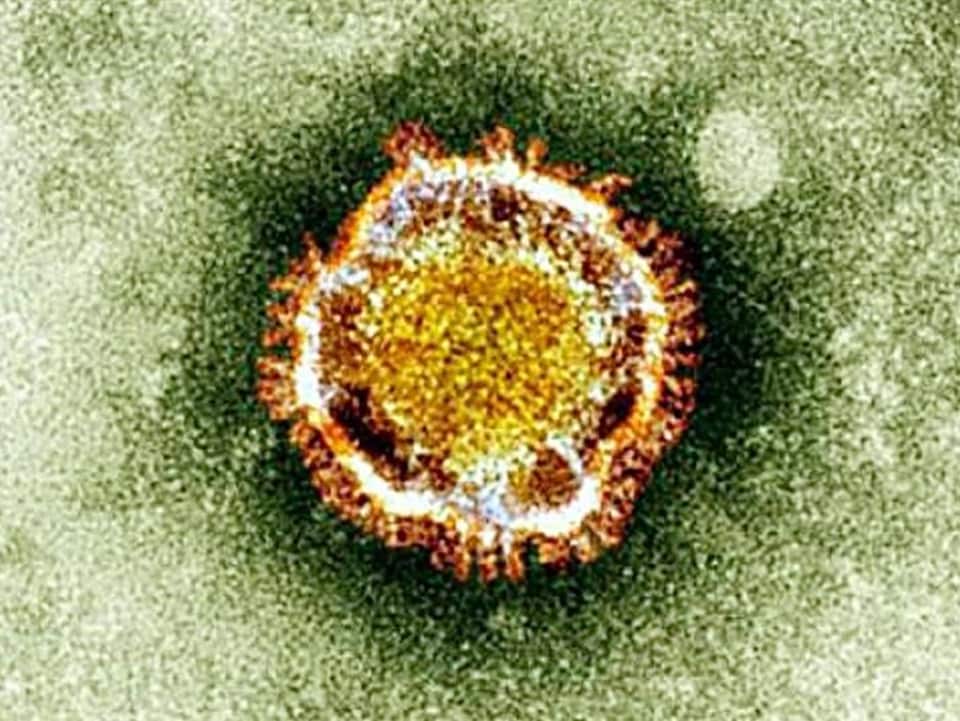 Le coronavirus du SRAS vu sous un microscope.