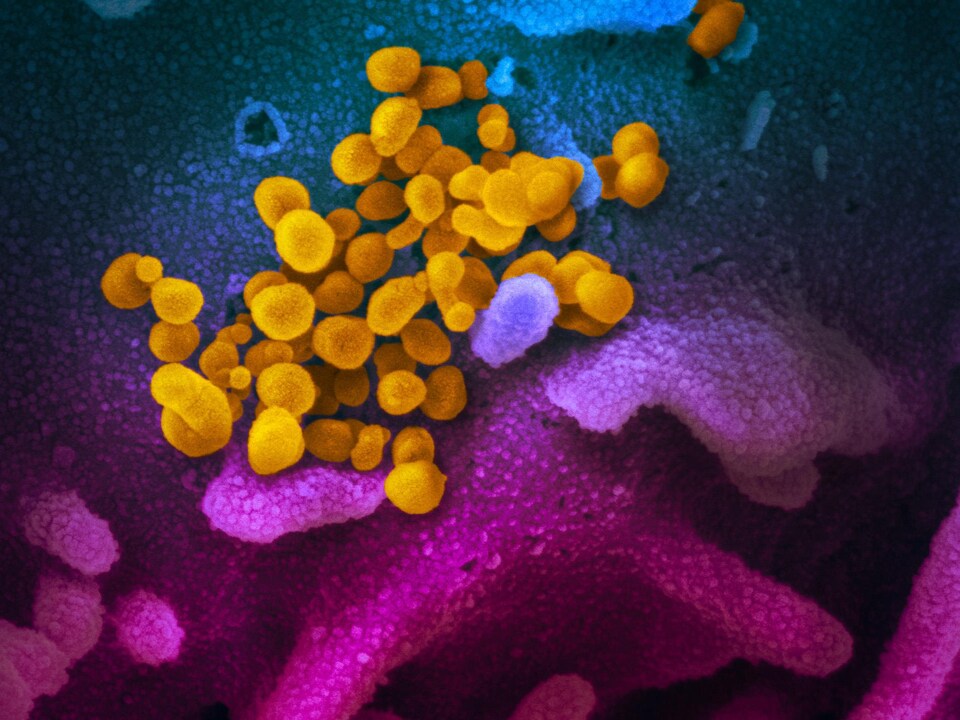 Image montrant le SARS-CoV-2 qui se développe à la surface de cellules (bleu/rose) cultivées en laboratoire.