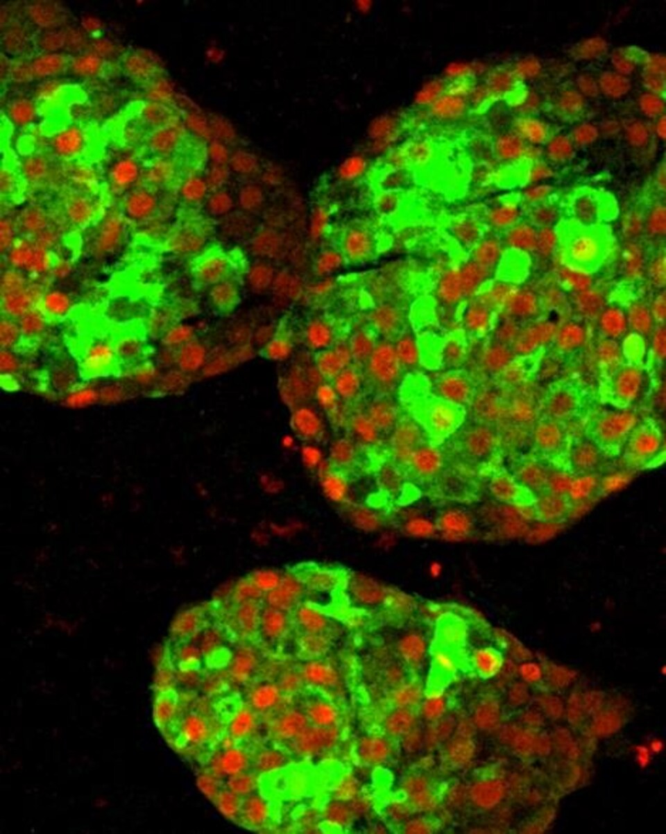 Des grappes de cellules bêta pancréatiques dérivées de cellules souches pluripotentes humaines.