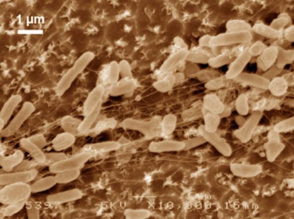 Coupe de microscope montrant la bactérie mangeuse de plastique Ideonella sakaiensi.