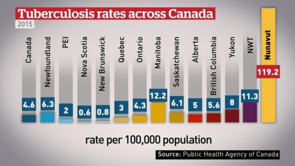 Le taux de tuberculose au Nunavut est 26 fois plus élevé que la moyenne nationale.