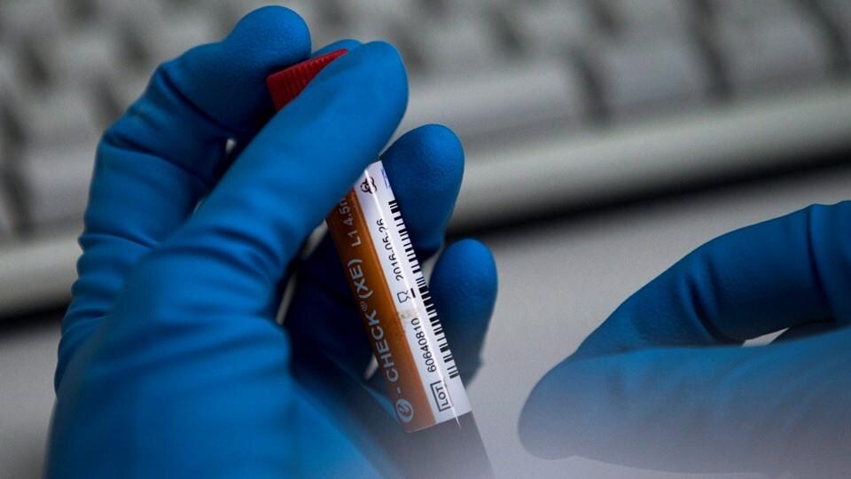 Des mains manipulent l'éprouvette dans un laboratoire.
