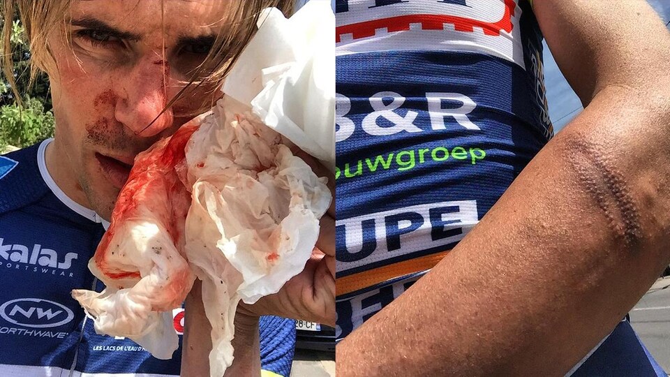 Le cycliste Yoann Offredo après son incident.