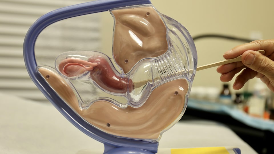 Une reproduction d'un vagin et utérus avec une main qui insère un bâton pour récolter des cellules.