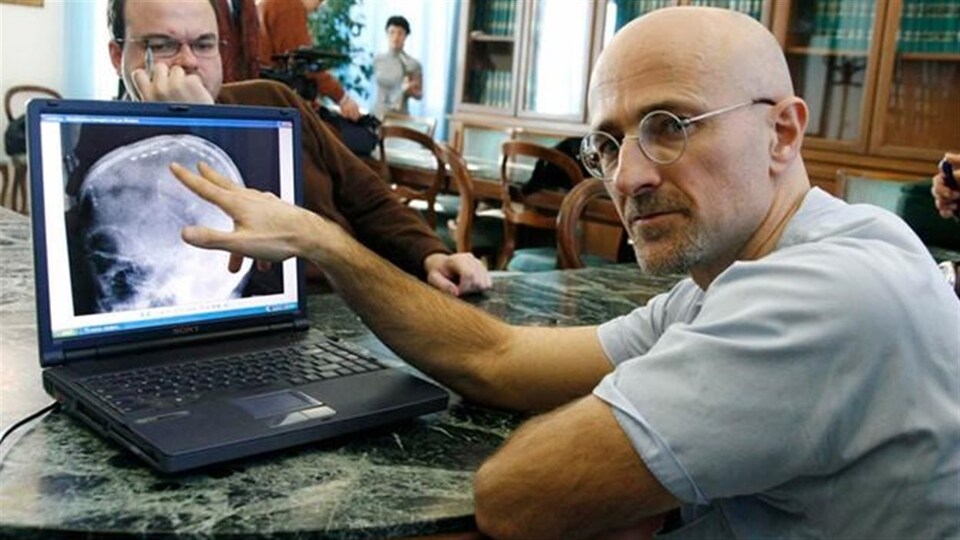Le neurochirurgien Sergio Canavero pointe la radiographie d'un cerveau sur un écran d'ordinateur.