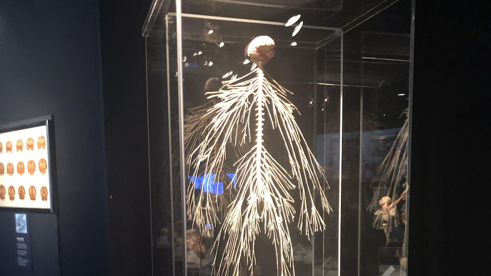 L’exposition Body Worlds revient à Halifax RadioCanada.ca