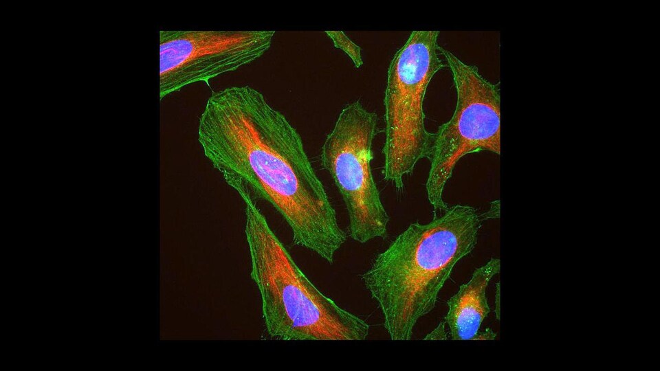Les protéines cellulaires sont visibles par fluorescence ; l'actine en vert, la vimentine en rouge et l'ADN bleu