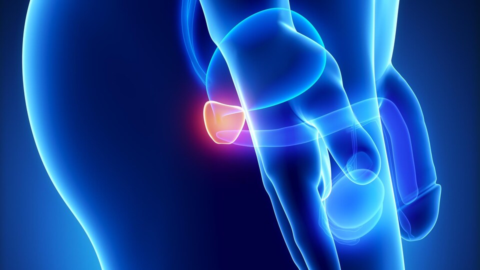 La prostate d'un homme