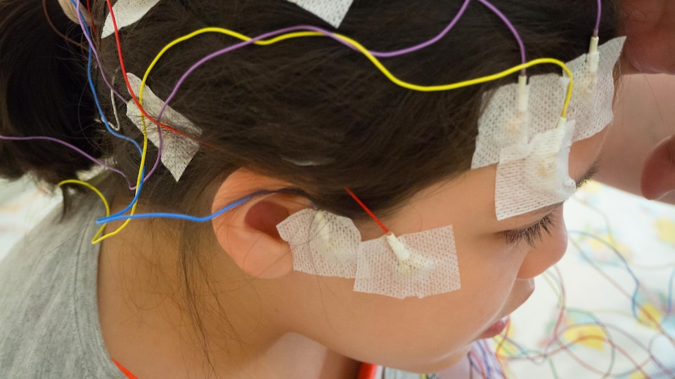 Une femme avec des électrodes multicolores sur la tête.