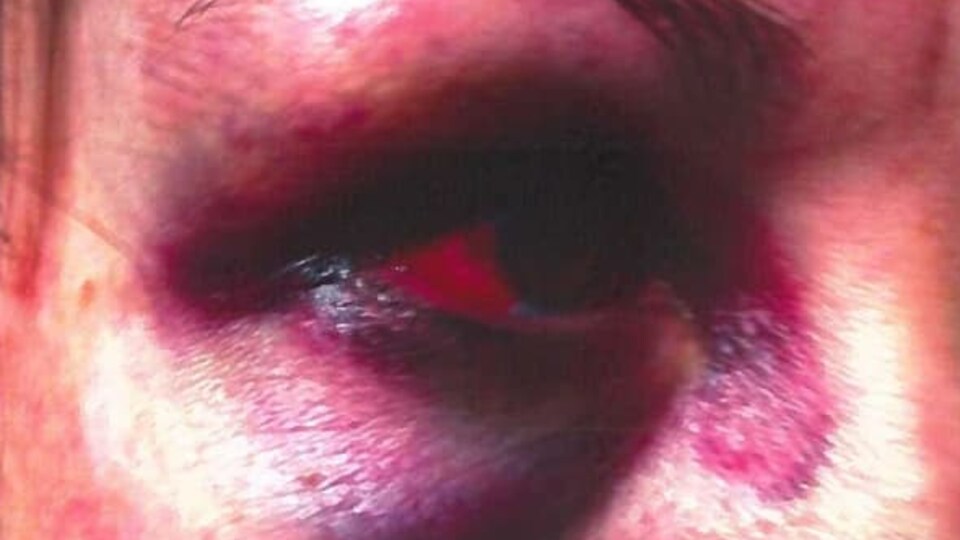 Une assistante en éducation du N.-B. qui a subi un incident de violence en milieu scolaire.