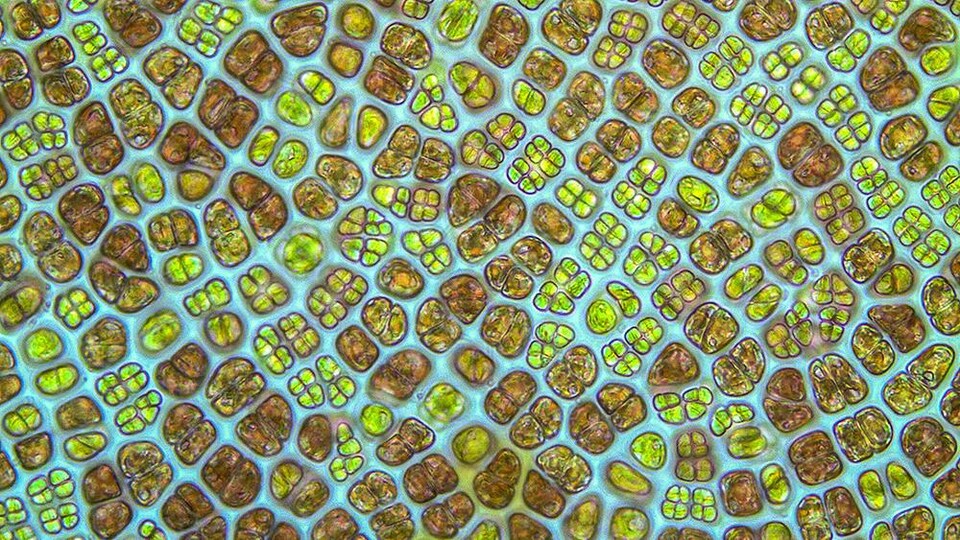 Des cellules colorées