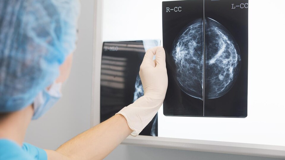 Une médecin tient une mammographie devant un écran lumineux.