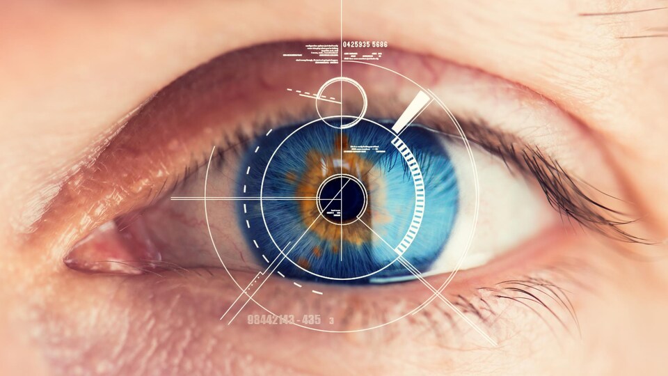 Un oeil.