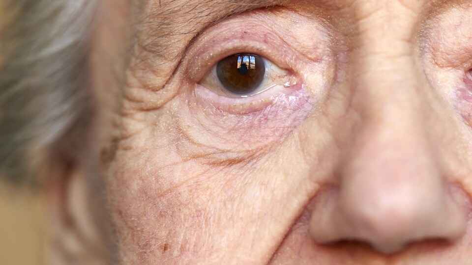 Plan serré d'une femme atteinte d'Alzheimer.