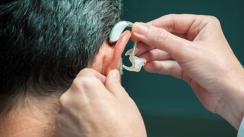 Un médecin insère un appareil auditif dans l’oreille droite d’un homme.
