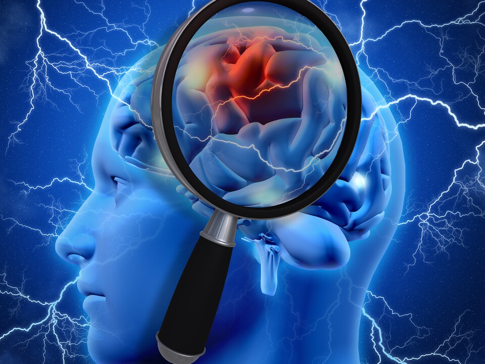Le cerveau humain.