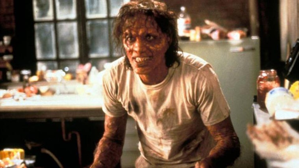 A man with a disfigured face and body.