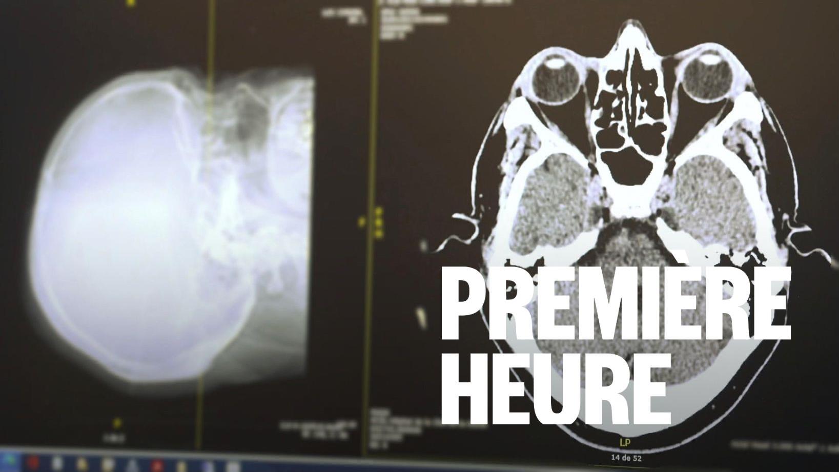 Mois de sensibilisation de l’Alzheimer : qu’en est-il des autres troubles neurocognitifs?