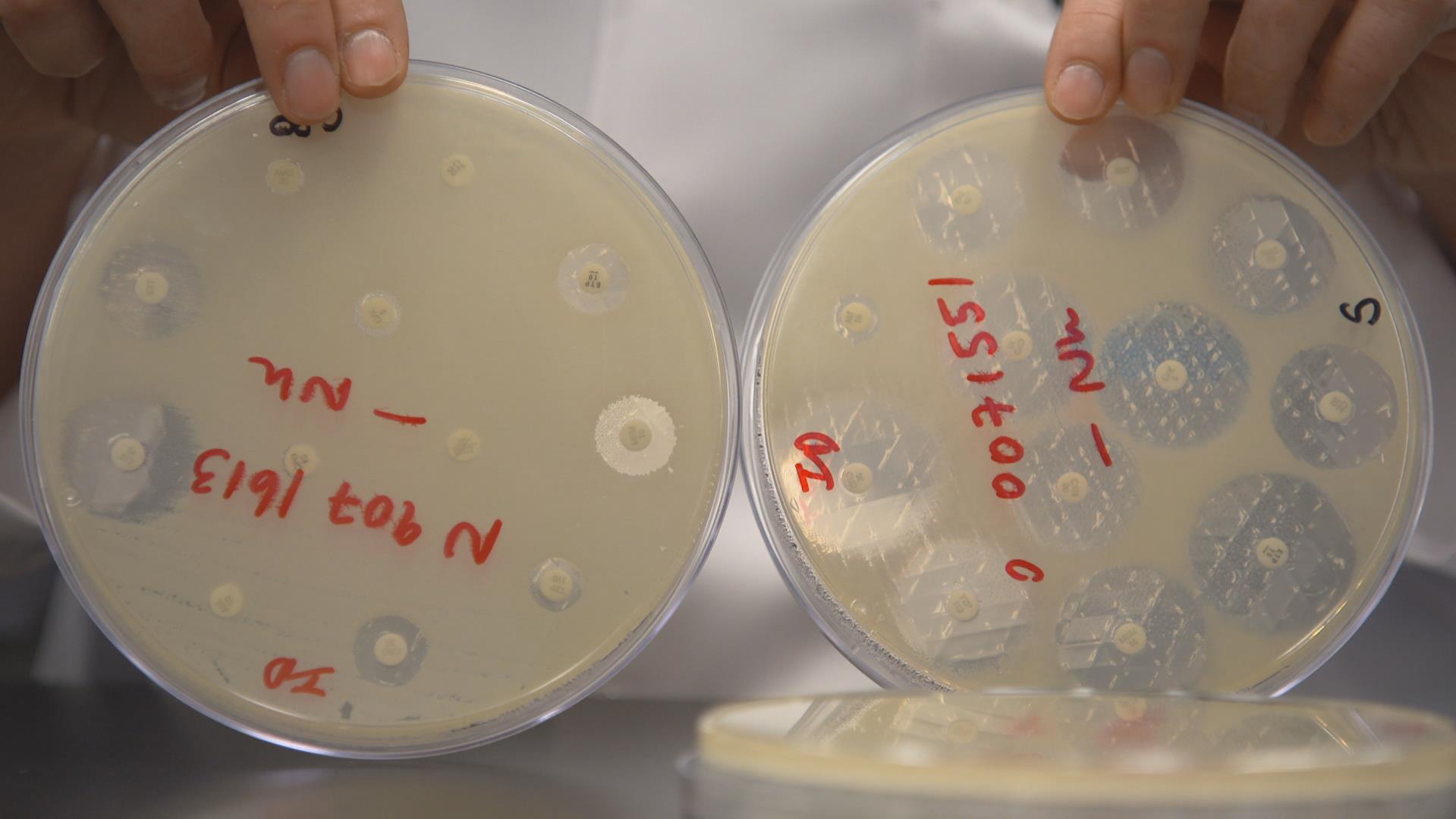 Dans ces boîtes de Petri, chacune des petites pastilles est imbibée d’un antibiotique différent. Le film blanchâtre qui recouvre le plat de Petri est un tapis de bactéries. À droite, une culture de bactérie typique des années 80, sensible à presque tous les antibiotiques. Elle ne parvient pas à se multiplier autour de la majorité des pastilles : les médecins ont beaucoup de choix thérapeutiques. À gauche, une culture d’EPC, résistante à presque tous les antibiotiques.
