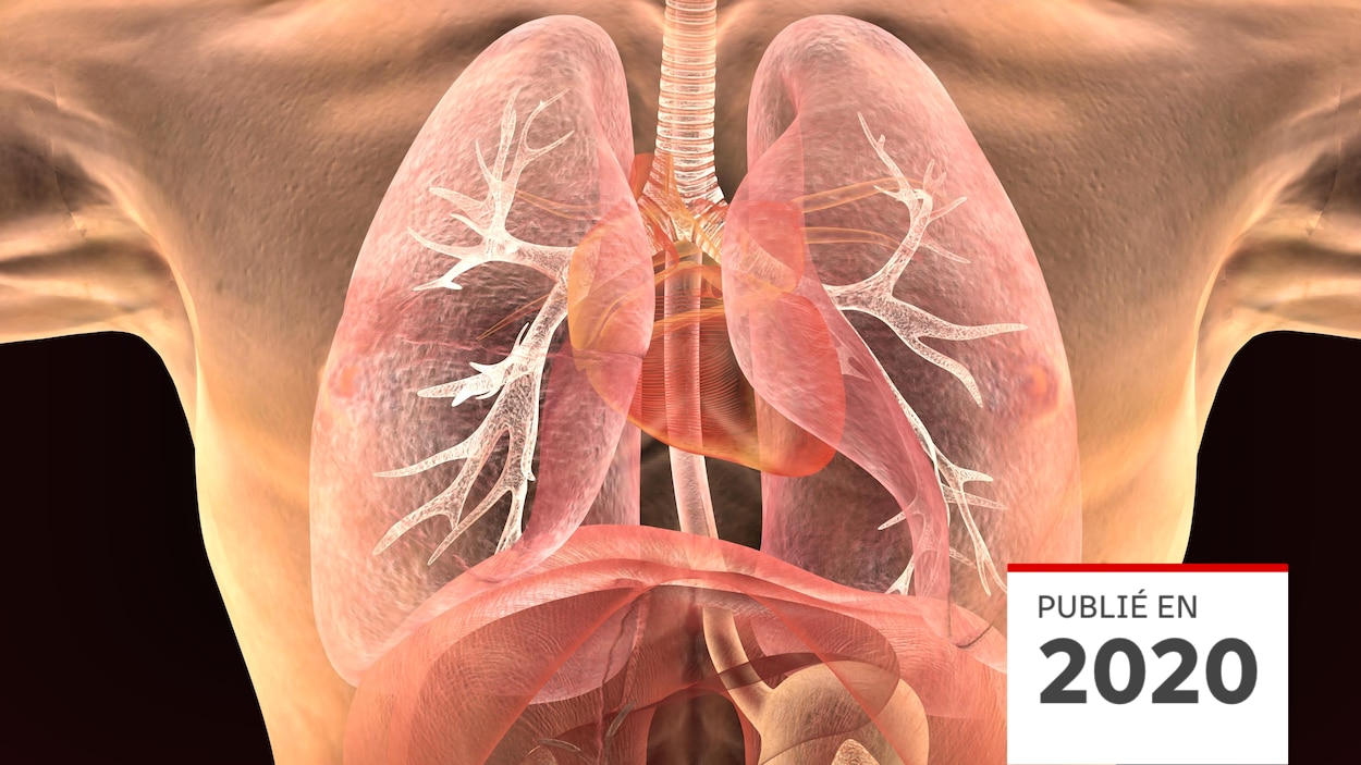 Comment la COVID-19 s'attaque aux poumons | COVID-19 : tout sur la ...