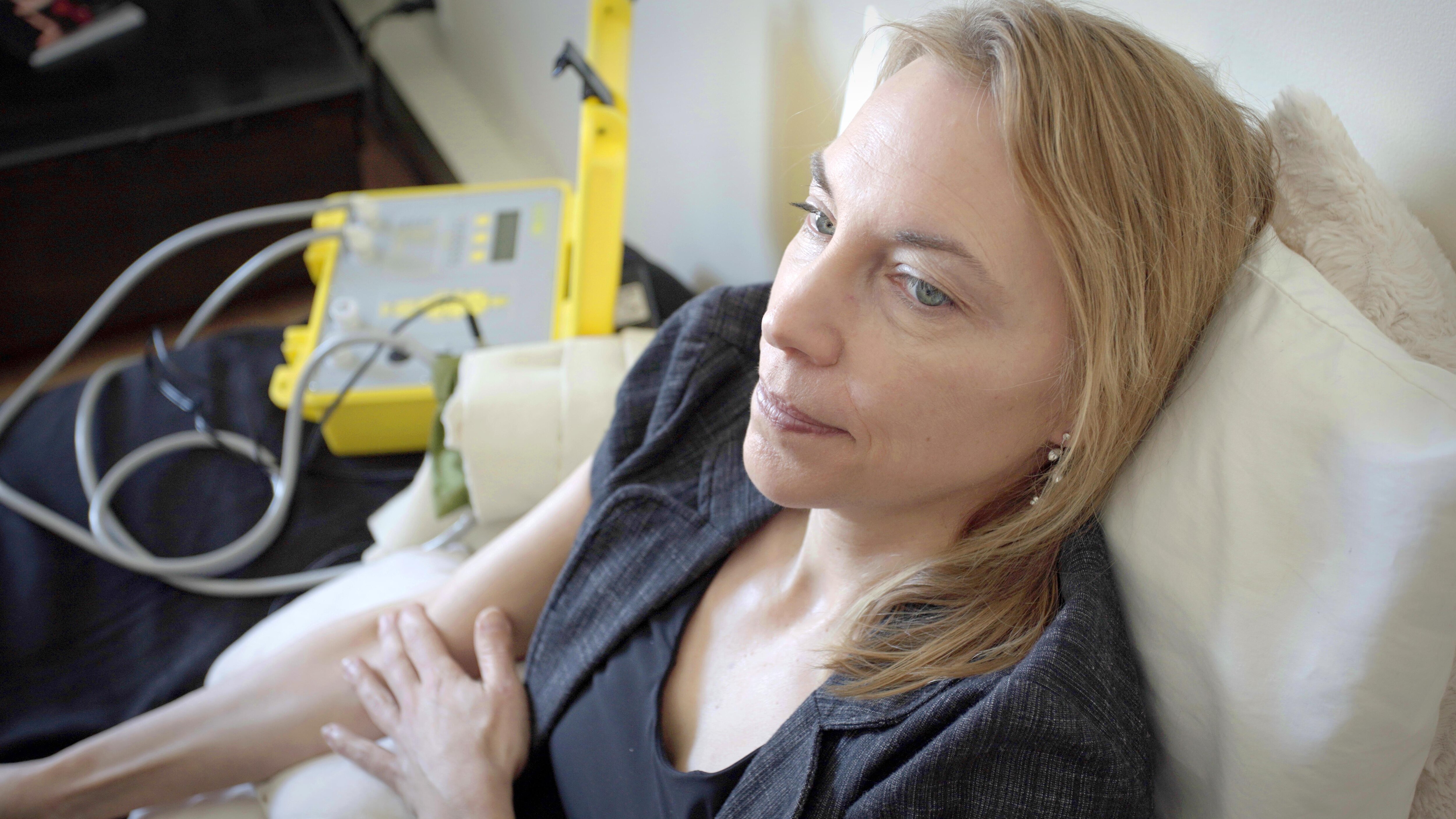 Rencontre avec le syndrome de fatigue chronique