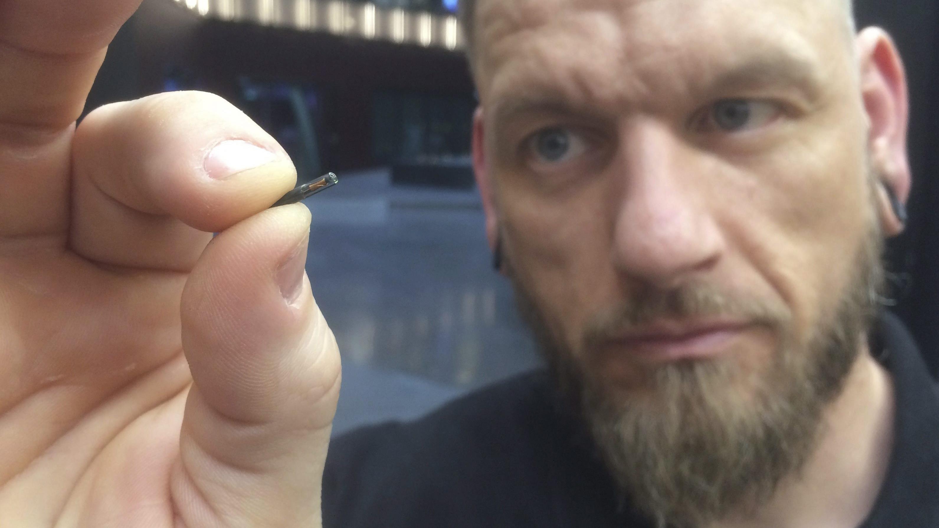 Des Implants Sous Cutanes Pour Reperer Vos Enfants Radio Canada Ca Des Implants Sous Cutanes Pour Reperer Vos Enfants Radio Canada Ca