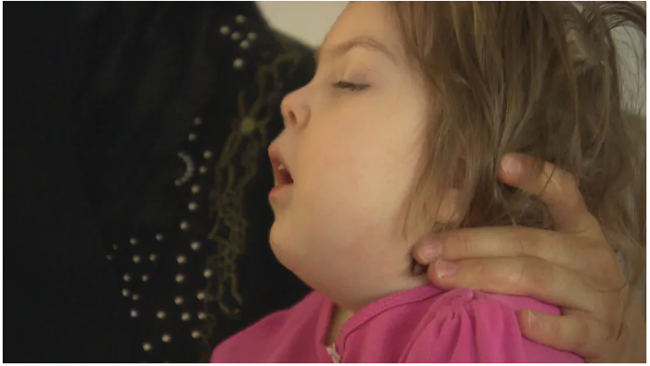 Deux Ans Apres Une Operation Risquee La Petite Ebrar Fait Face A Des Defis Importants Radio Canada Ca Deux Ans Apres Une Operation Risquee La Petite Ebrar Fait Face A Des Defis Importants Radio Canada Ca