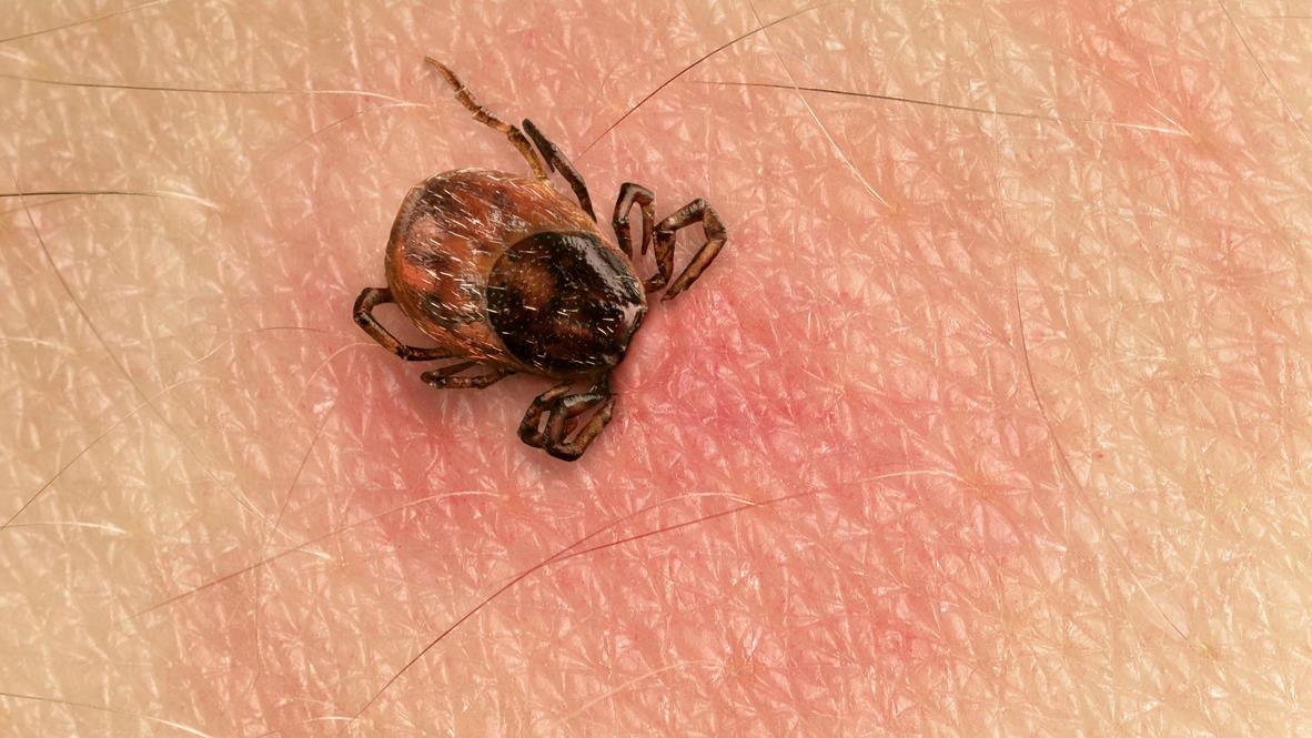 Les Tiques Et La Maladie De Lyme 6 Choses A Retenir Radio Canada Ca Les Tiques Et La Maladie De Lyme 6 Choses A Retenir Radio Canada Ca