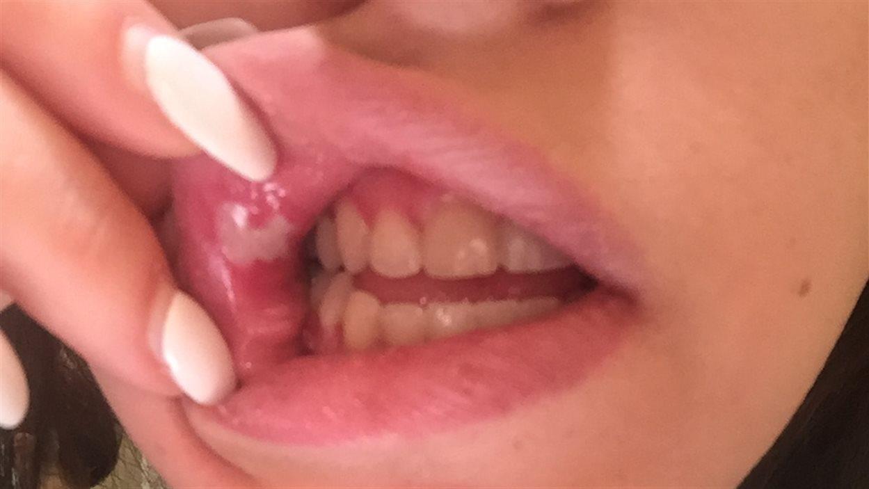 Les Dentistes Demandent A Quebec D Encadrer Le Blanchiment Des Dents Radio Canada Ca