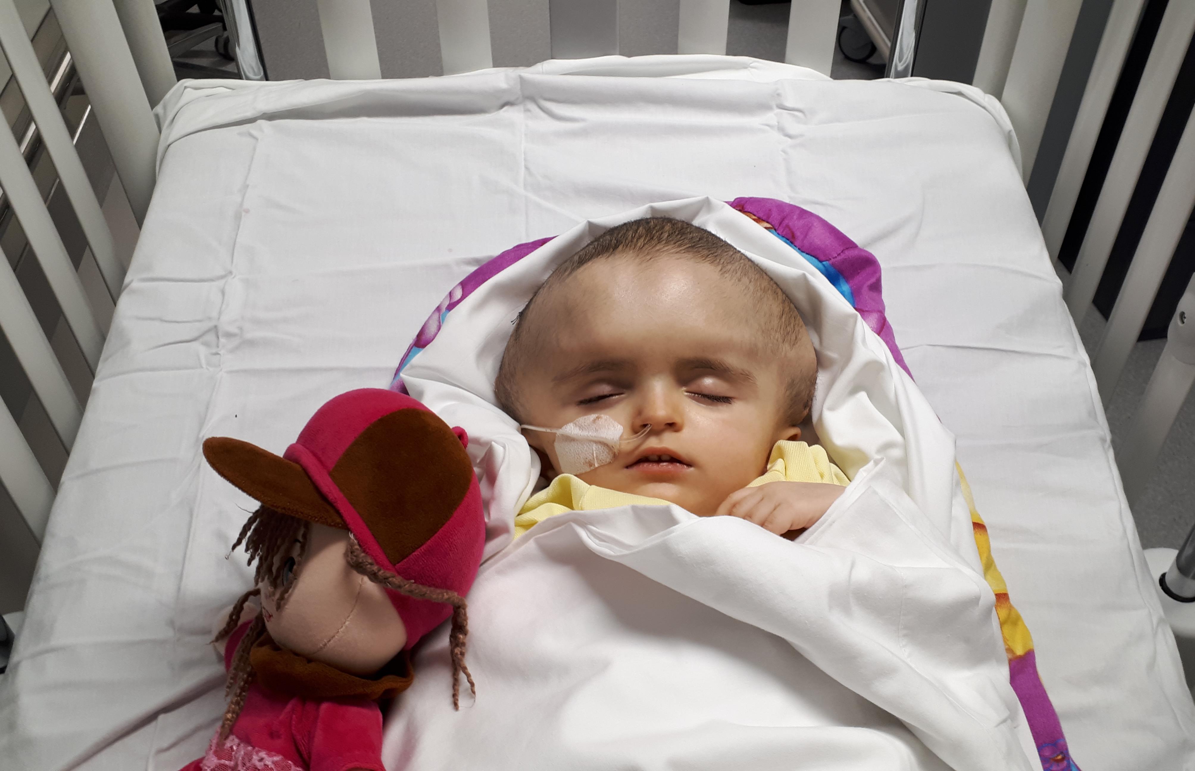 Reconstruire Le Crane D Une Fillette Piece Par Piece L Exploit De Chirurgiens De Sainte Justine Radio Canada Ca