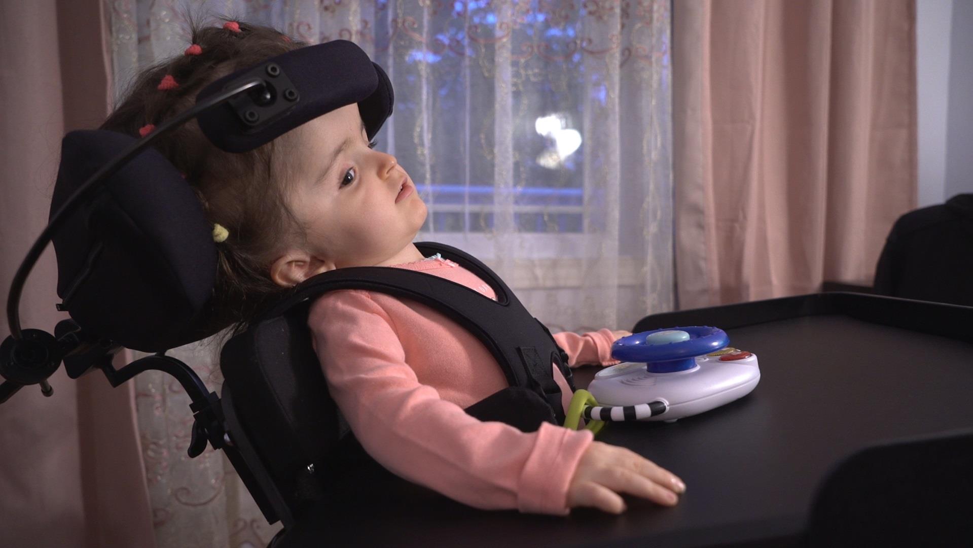 Reconstruire Le Crane D Une Fillette Piece Par Piece L Exploit De Chirurgiens De Sainte Justine Radio Canada Ca