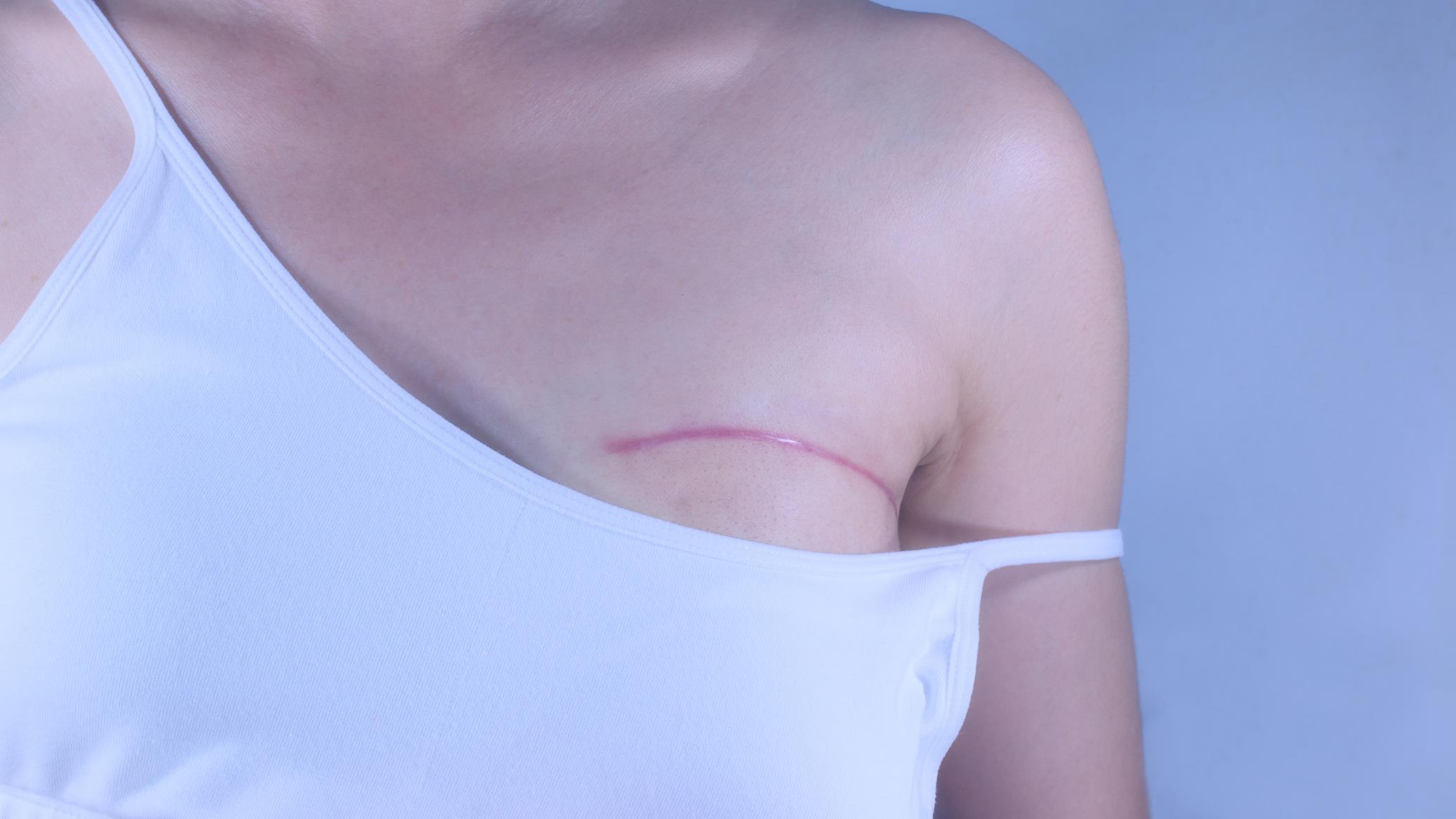 Réanimation : les seins et les soutiens-gorges peuvent tuer