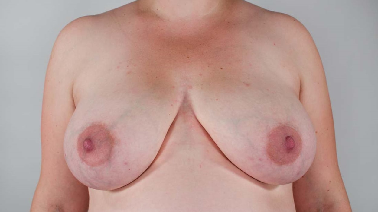 Des seins de femme Des seins de femme