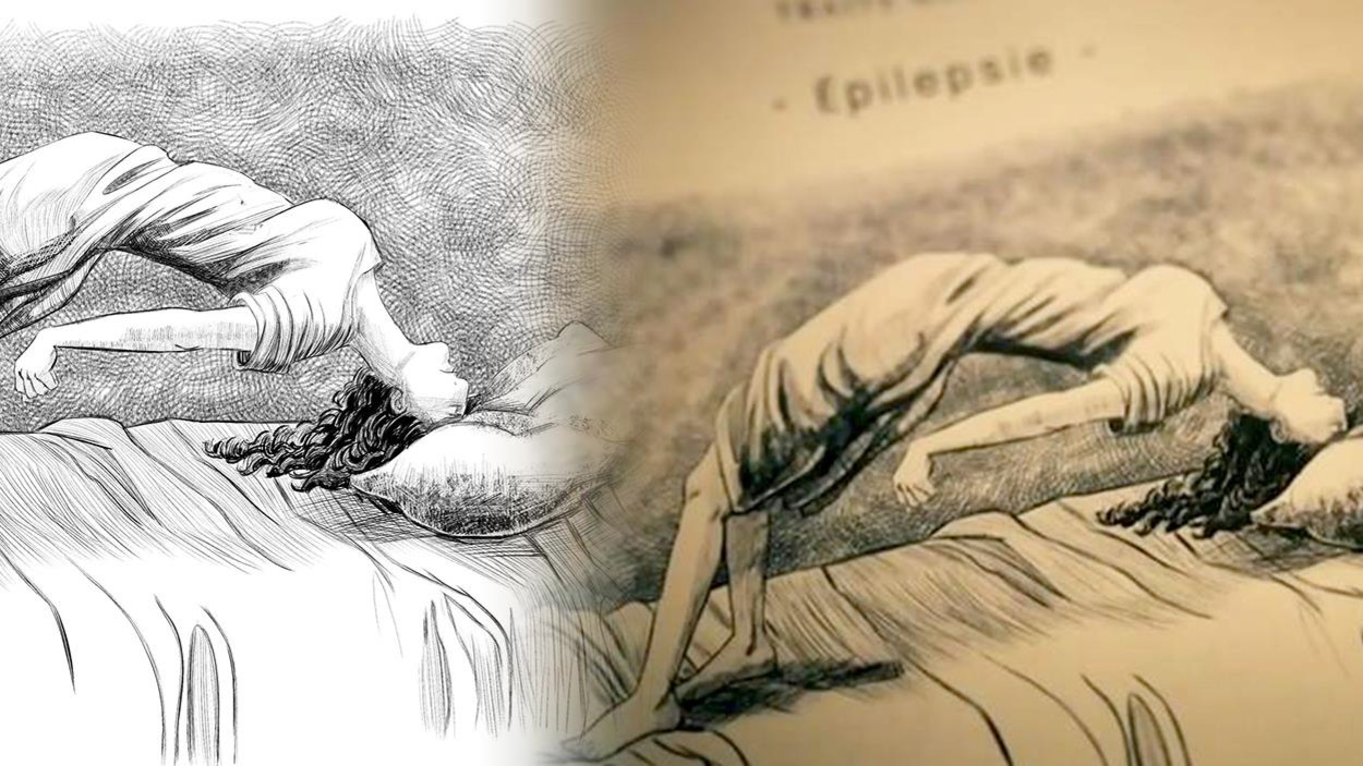 Illustration d'une crise d'épilepsie dans un livre de médecine, dans la séries Les pays d'en haut. Illustration d'une crise d'épilepsie dans un livre de médecine, dans la séries Les pays d'en haut.